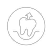 Tooth extraction