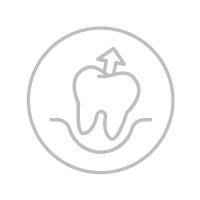 Εξαγωγή δοντιών Tooth extraction