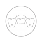 Οδοντική γέφυρα/στεφάνη Restorative dentistry