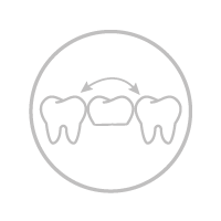 Οδοντική γέφυρα/στεφάνη Restorative dentistry