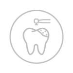 Έμφραξη (σφράγισμα) Dental filling