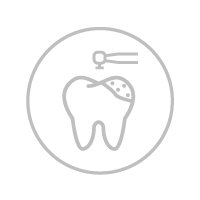 Έμφραξη (σφράγισμα) Dental filling